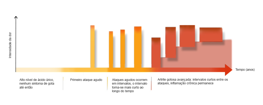 gota-e-artrite-gotosa-mal-tratadas