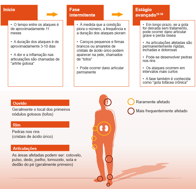 gota-partes-do-corpo-afetadas